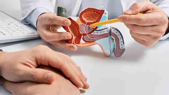 LA SALUD DE LA PROSTATA